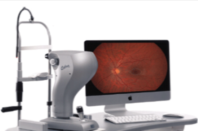 Fundus camera眼底照相機