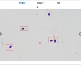 SpermShapeAnalysis V1 樸華精子形態分析軟件