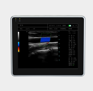 wEye6 威爾德平板式全數字彩色多普勒超聲診斷系統