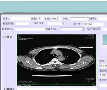 RLMI-PACS醫學影像存儲與傳輸系統軟件智遠匯壹