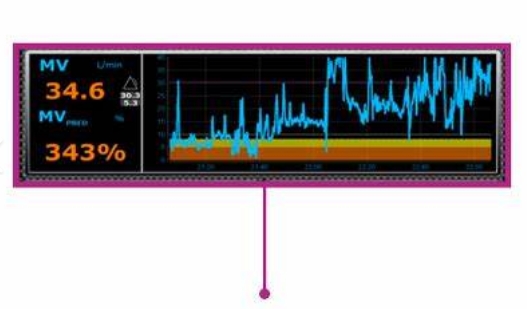 OHM-DPI-100 呼吸功能數據監測分析軟件橙心