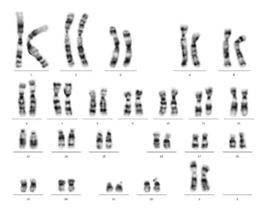 KaryoXbot I 染色體核型分析軟件笑納