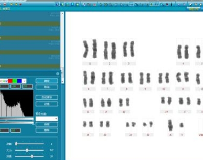 dInsight C 染色體核型分析軟件迪英加