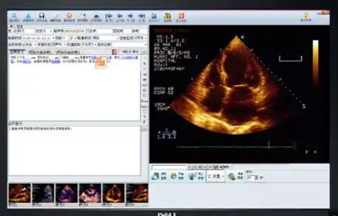 SonoStation 超聲影像工作站軟件