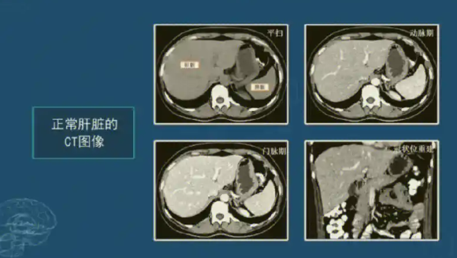 XMQB-Liver V2.0 肝臟影像處理軟件